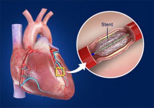 treatment of urethral stricture in pune