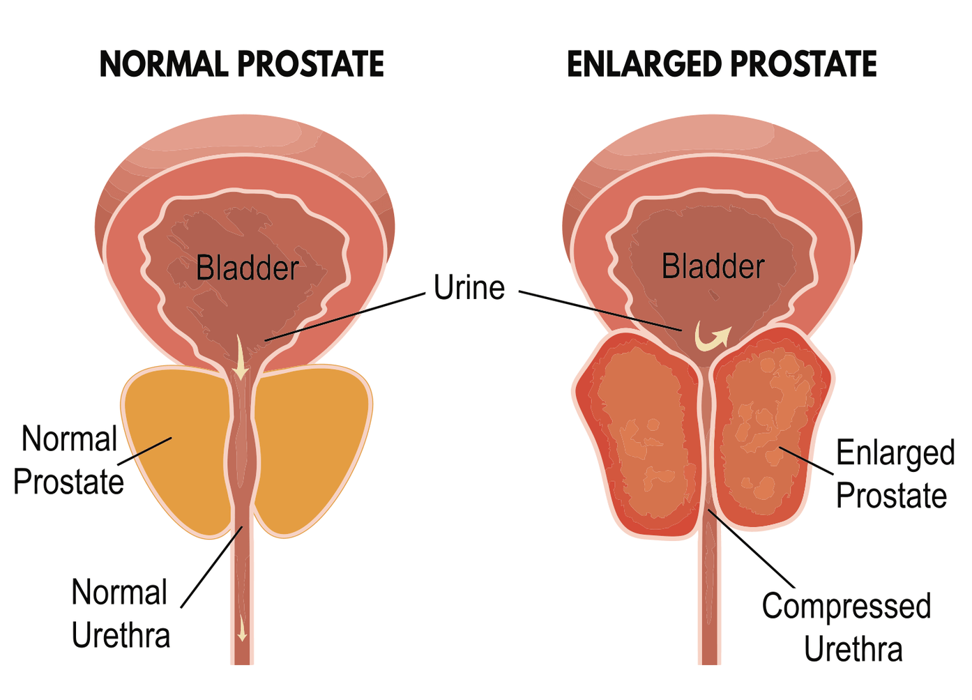 Best urologist in Pune,India - Dr. Ketan Vartak